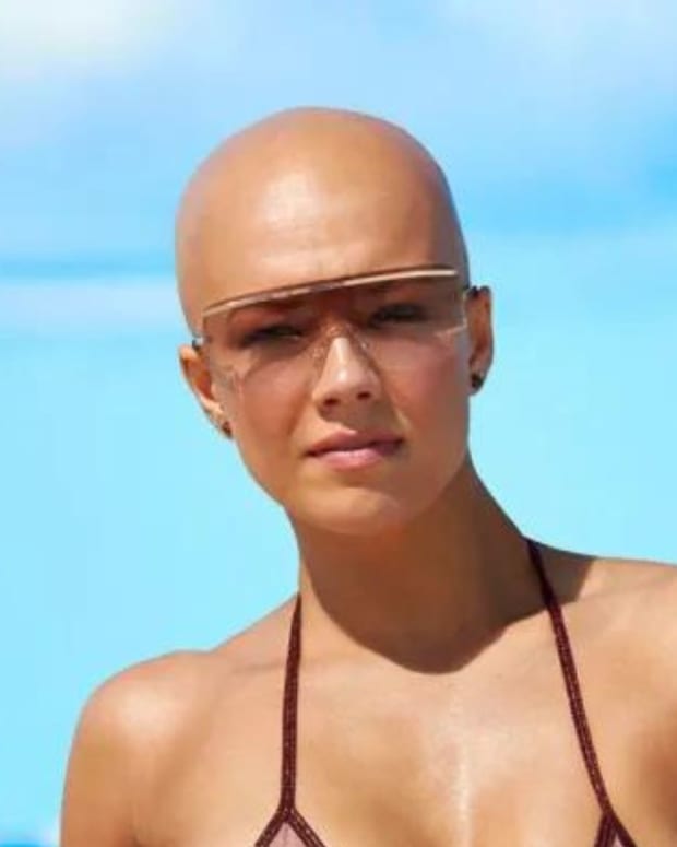 SI Swimsuit finalist with alopecia, Christie Valdiserri, on her
