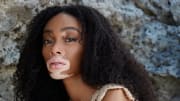 Winnie Harlow was photographed by Laretta Houston in Great Exuma, Bahamas.