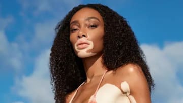 Winnie Harlow