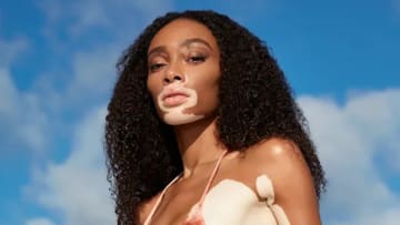 Winnie Harlow