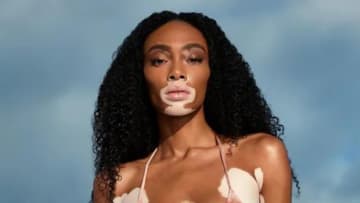 Winnie Harlow