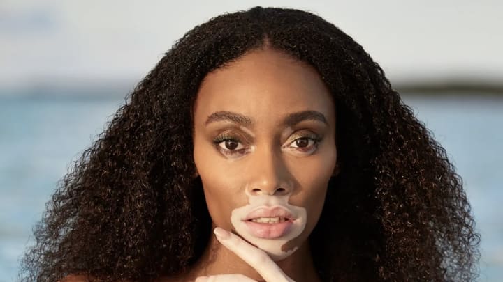 Winnie Harlow was photographed by Laretta Houston in Great Exuma, Bahamas. Winnie Harlow was photographed by Laretta Houston in Great Exuma, Bahamas.