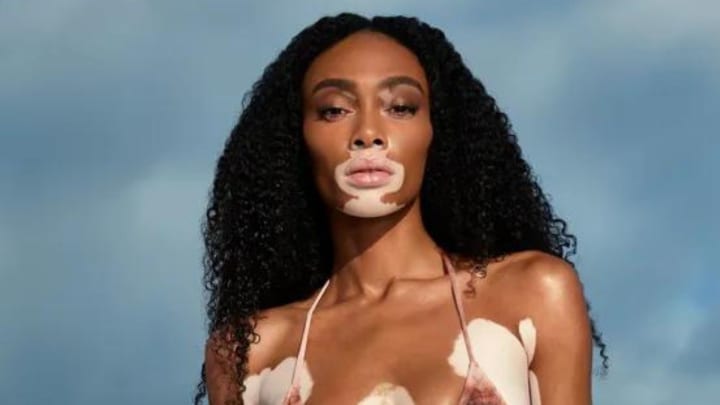 Winnie Harlow