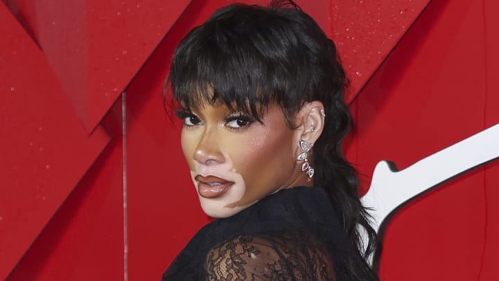 Winnie Harlow Winnie Harlow