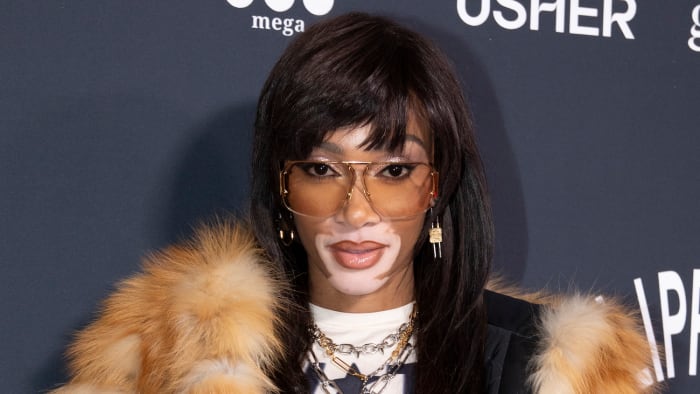 Winnie Harlow