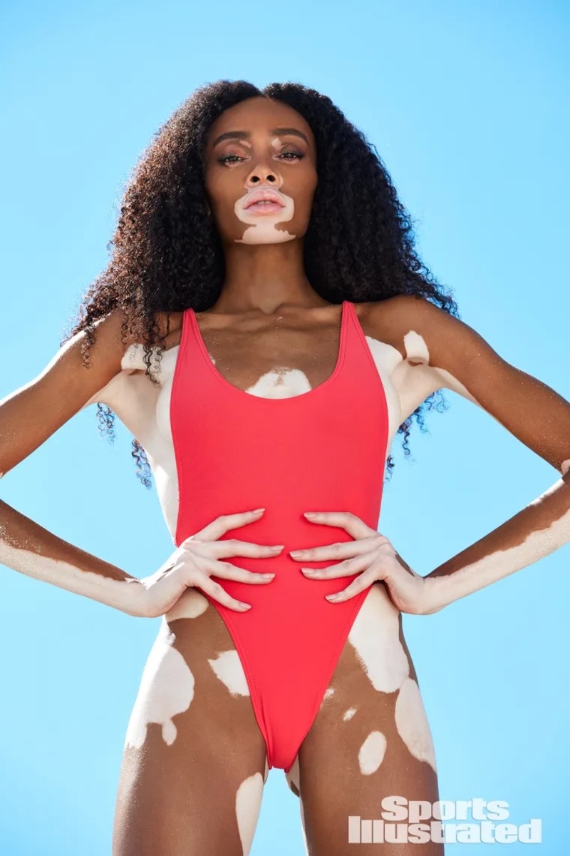 Winnie Harlow looks at the camera with her hands on her hips, wearing a scoop-neck red one-piece.
