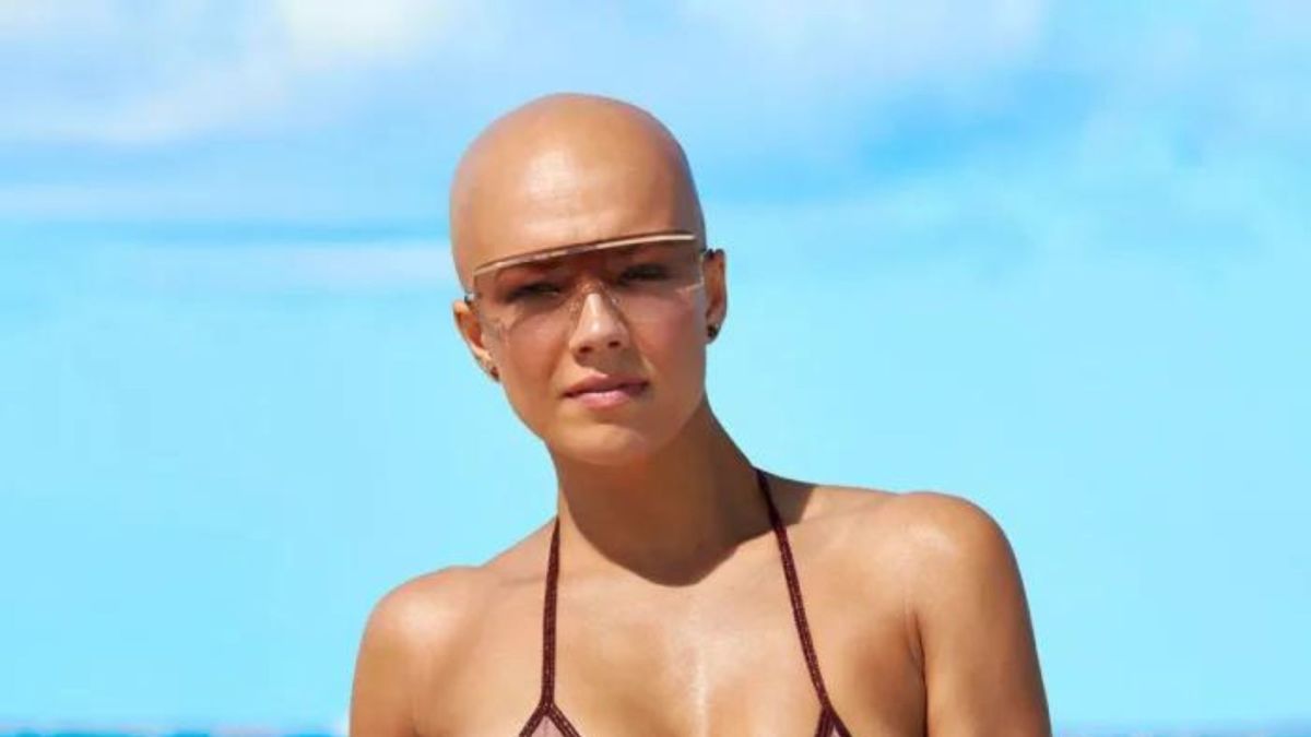 Model With Alopecia Featured In 'Sports Illustrated' Photoshoot